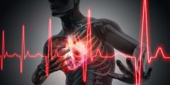 اعتلال عضلة القلب (MDI)