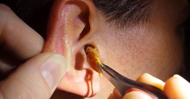 الاذن الاطفال التهاب عند عدوى الأذن